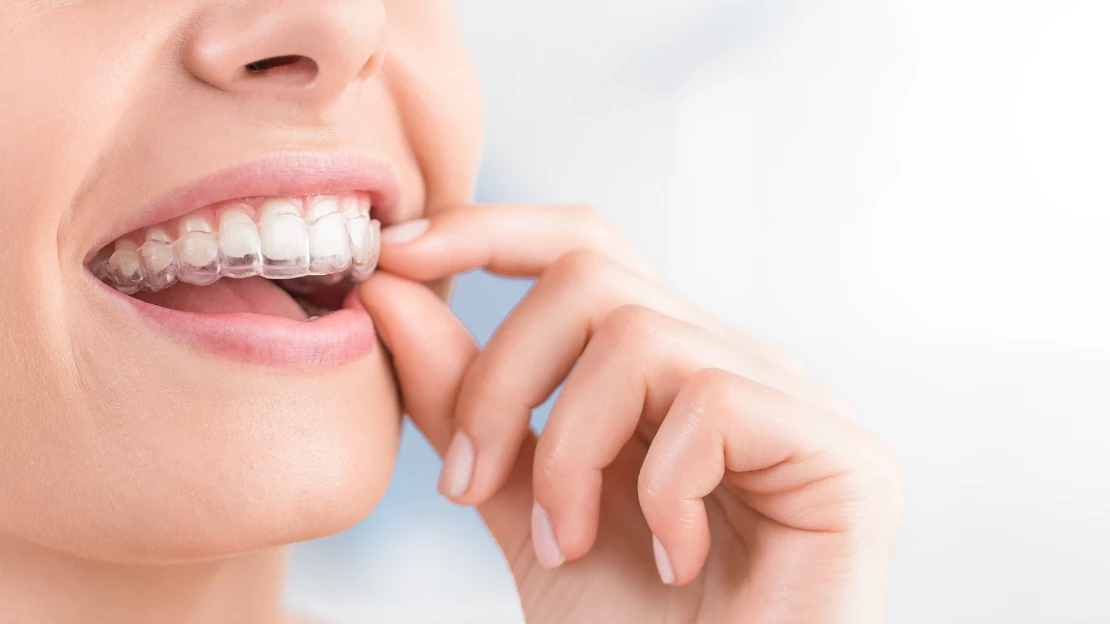 adult Invisalign   (1110 x 624 px).png